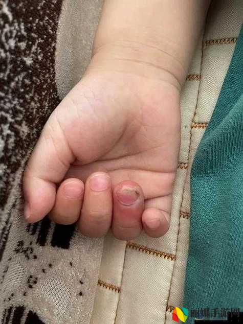 宝宝才两根手指就疼哭了
